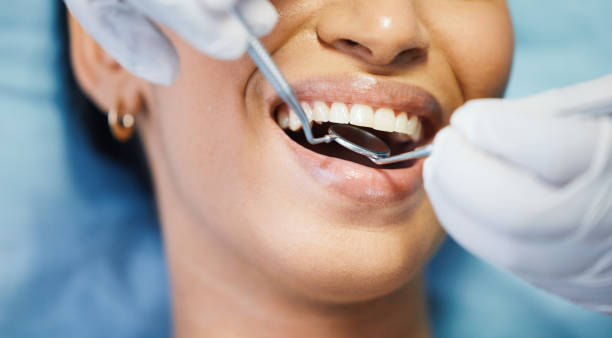 Best Broken or Chipped Tooth Repair in Topeka, KS