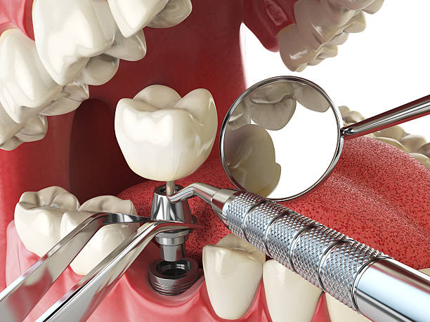 Best Emergency Treatment for Jaw Pain or Injury in Topeka, KS